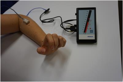 Rehabilitation of Upper Extremity Nerve Injuries Using Surface EMG Biofeedback: Protocols for Clinical Application